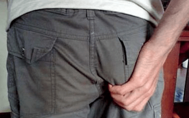 kruarja në anus si simptomë e pranisë së parazitëve