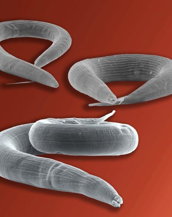 parazit pinworm që jeton në zorrë