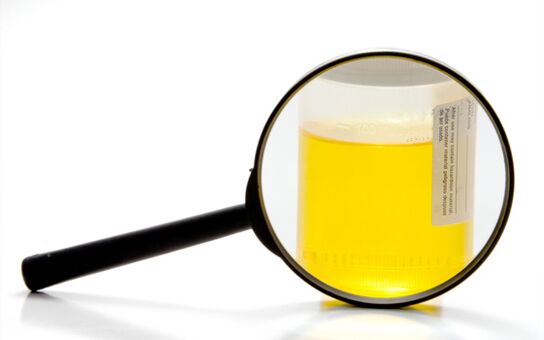 Ekzaminimi i urinës për të diagnostikuar skistozomiazën