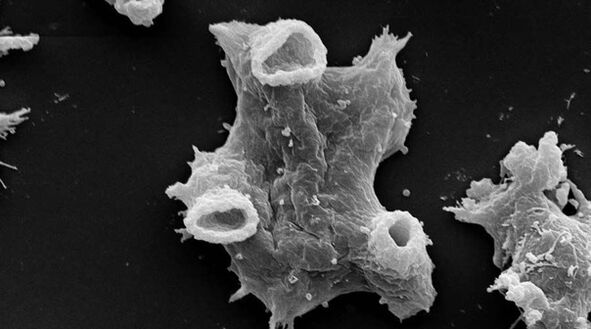 Negleria fowlera është një parazit protozoar i rrezikshëm për jetën e njeriut. 