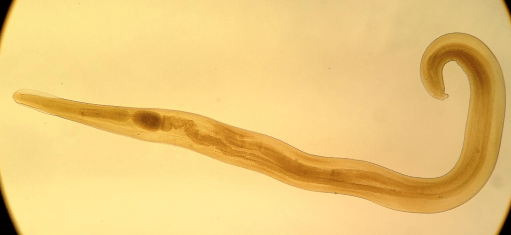 Penworm është një parazit i zakonshëm tek fëmijët. 